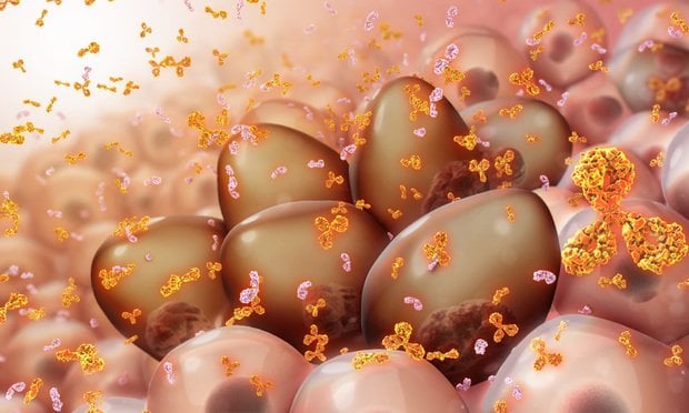 Multiple Myeloma