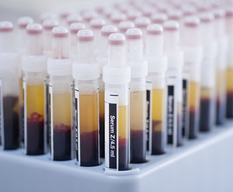 blood-test