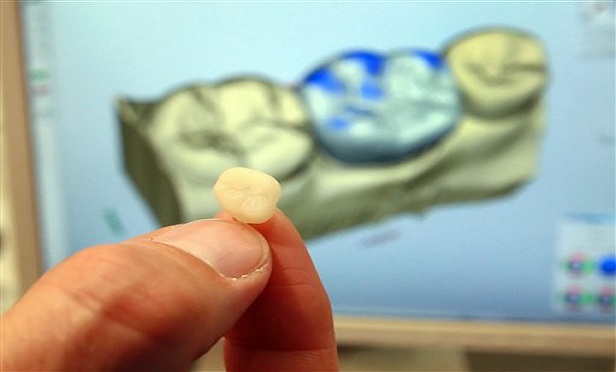 A dentist holding up a tooth in front of a computer-generated image of a row of teeth. (Photo: Eckehard Schulz/AP)