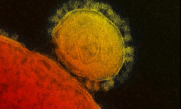 A highly magnified, digitally colorized transmission electron microscopic (TEM) image of a single, spherical, Middle East respiratory syndrome coronavirus (MERS-CoV) virion (Credit: National Institute of Allergy and Infectious Diseases)